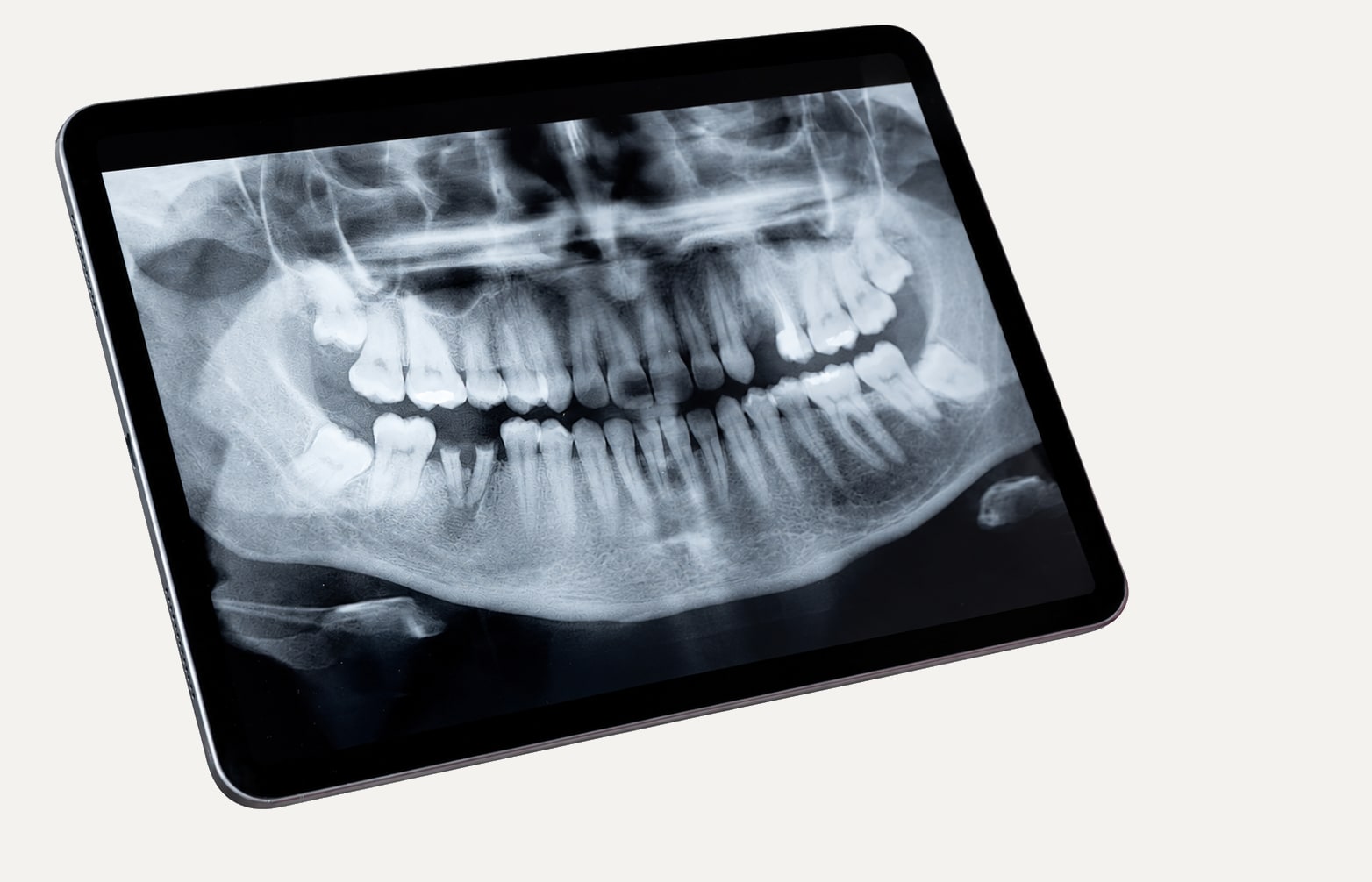 Röntgenaufnahme eines menschlichen Kiefers auf einem Tablet.